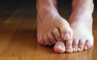 Causes of fungal nail treatment