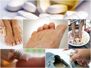 the fungus of the foot, the skin folk remedies