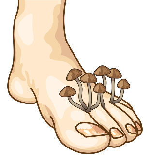 signs of the fungus
